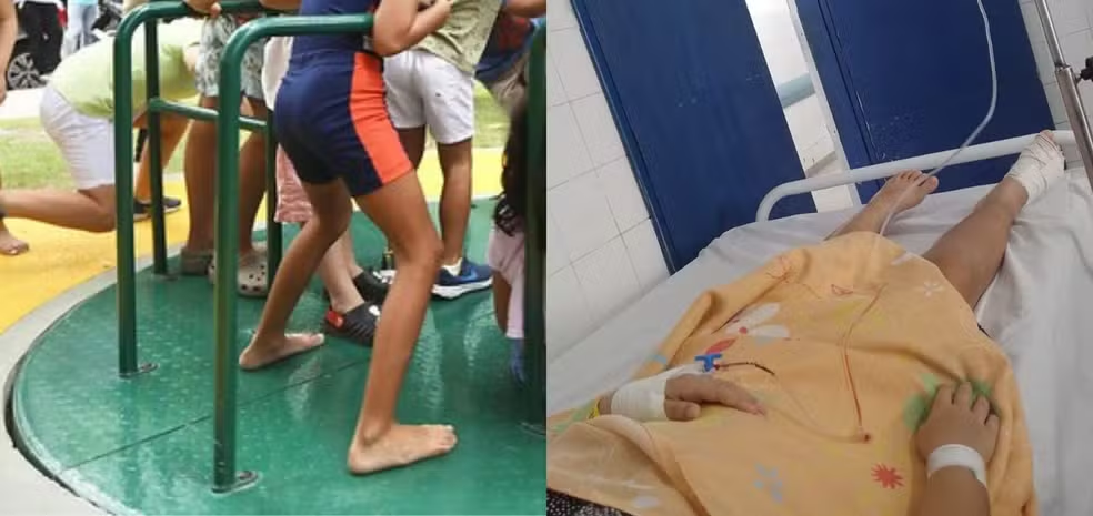 Acidente Playground Recife: Menina de 8 Anos tem dedo amputado
